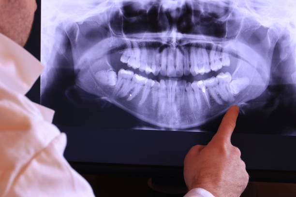 Best Emergency Root Canal Treatment in Browns Lake, WI